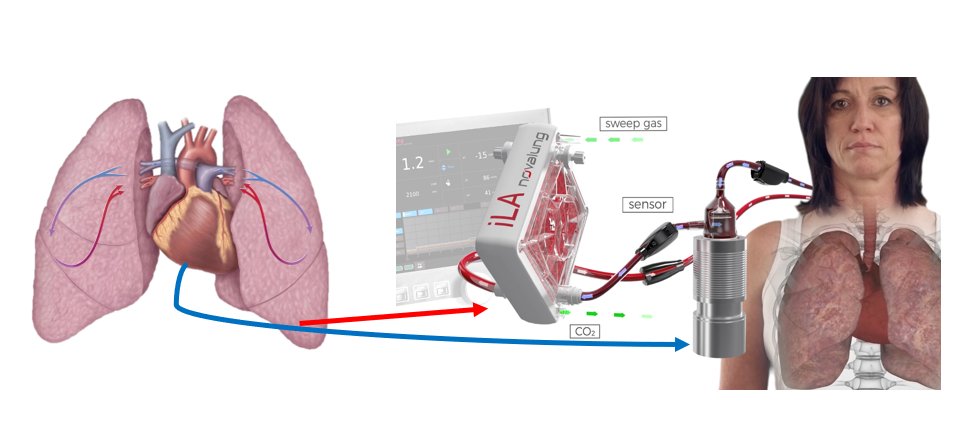 https://cloud.ctvstalk.com/asset/james-ecmo.png